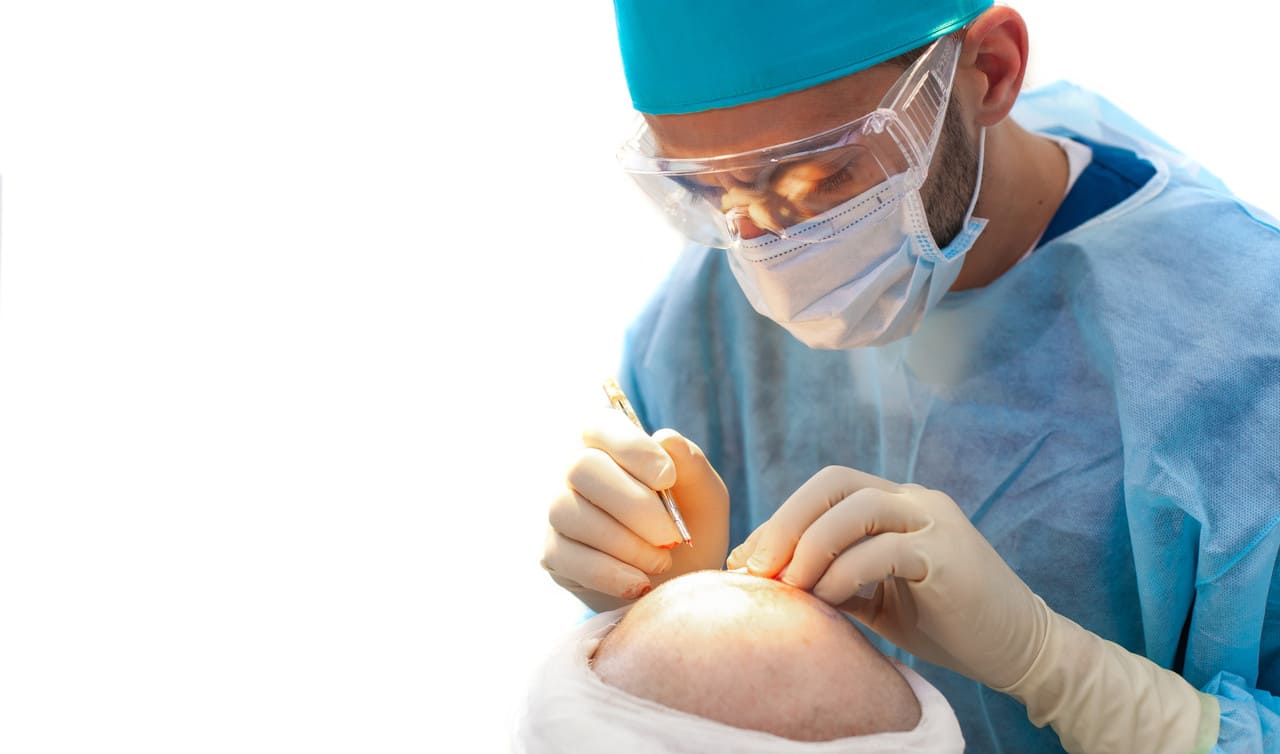 How long does a hair transplant take?