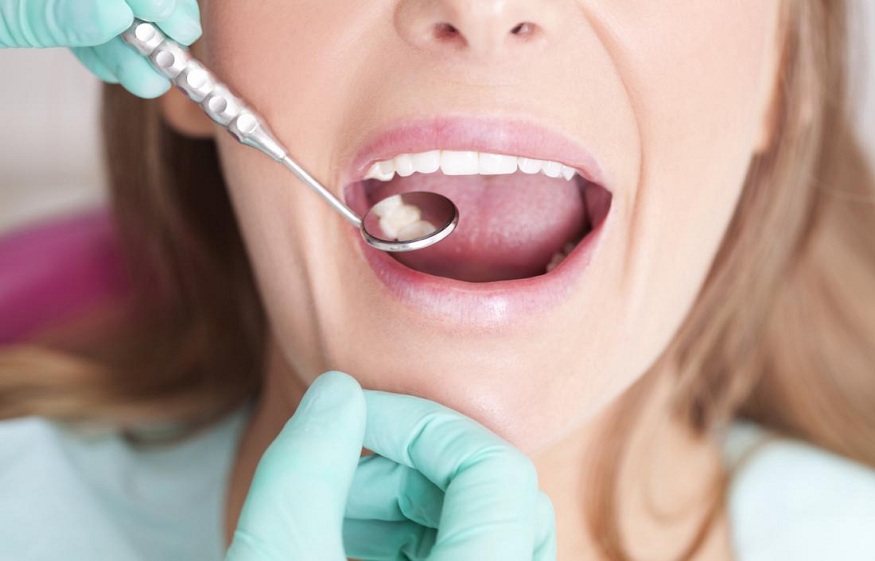 9 tips for taking care of your teeth