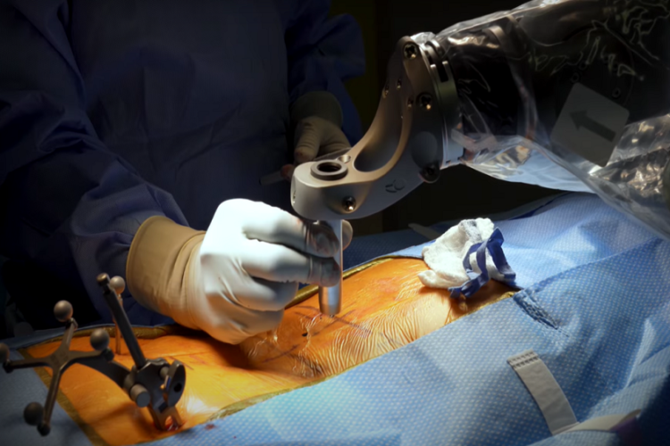 Spinal Surgery