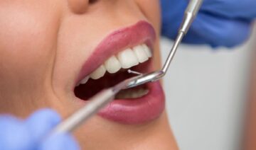 full mouth reconstruction San Francisco