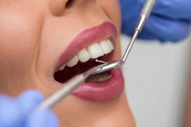 full mouth reconstruction San Francisco