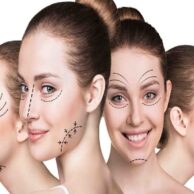 plastic surgery in Dubai