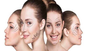 plastic surgery in Dubai